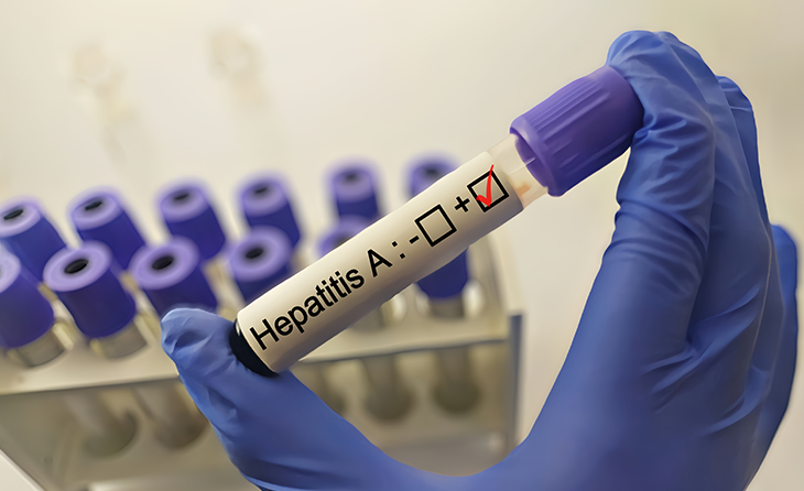 Hepatit A Hastalığı